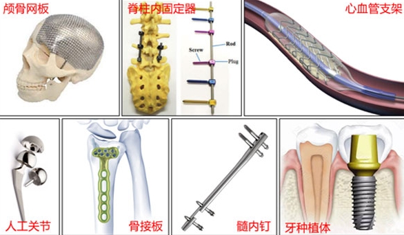 亚稳β钛合金新一代生物医用金属材料